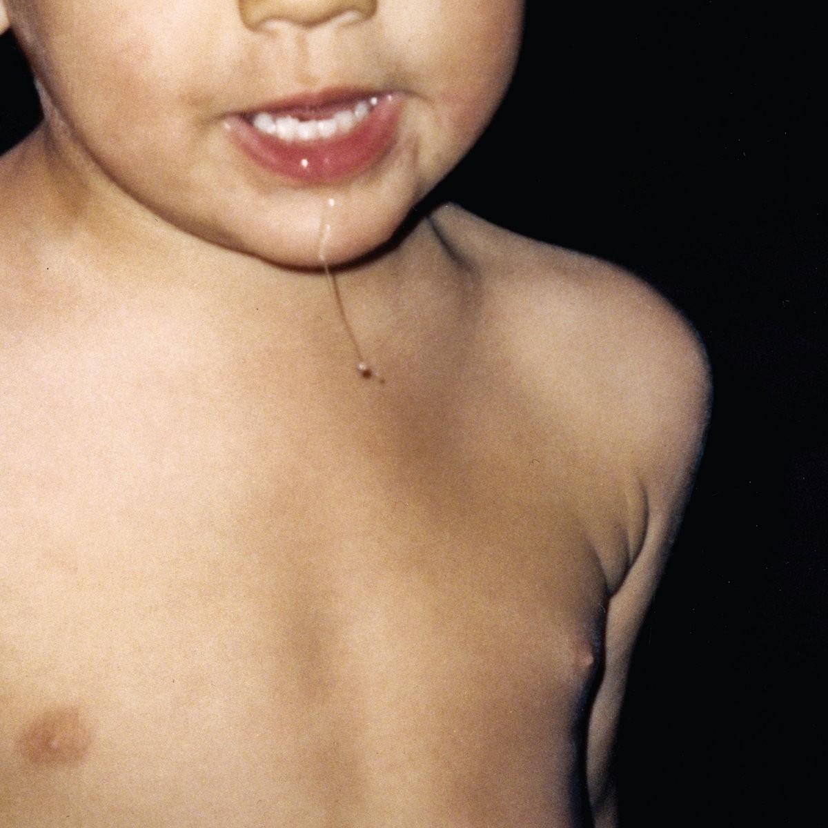 La Paloma - Todavia No (White Vinyl)