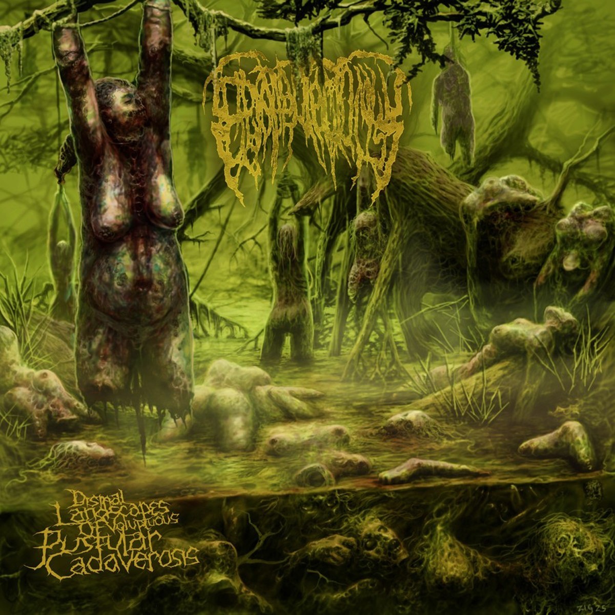 Epicardiectomy - Dismal Landscapes Of Voluptuous Pustular Cadaverosis